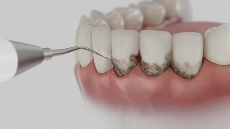 Reliable Dental Implants contractor in Bagdad, AZ by Smile Center Dentistry